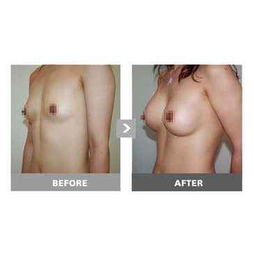 Slider image (5) HERSHE Plastic Surgery Dermatology Aesthetic Care Clinic